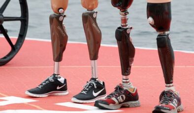 Özgürlüğünüzü Yeniden Kazanın: Protez Bacaklar
